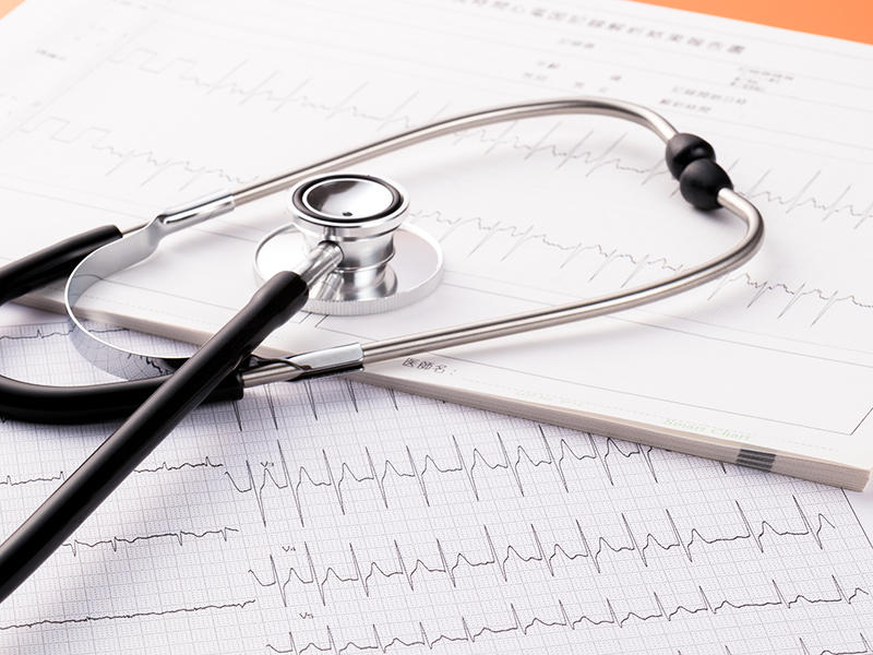 Electrocardiogram
