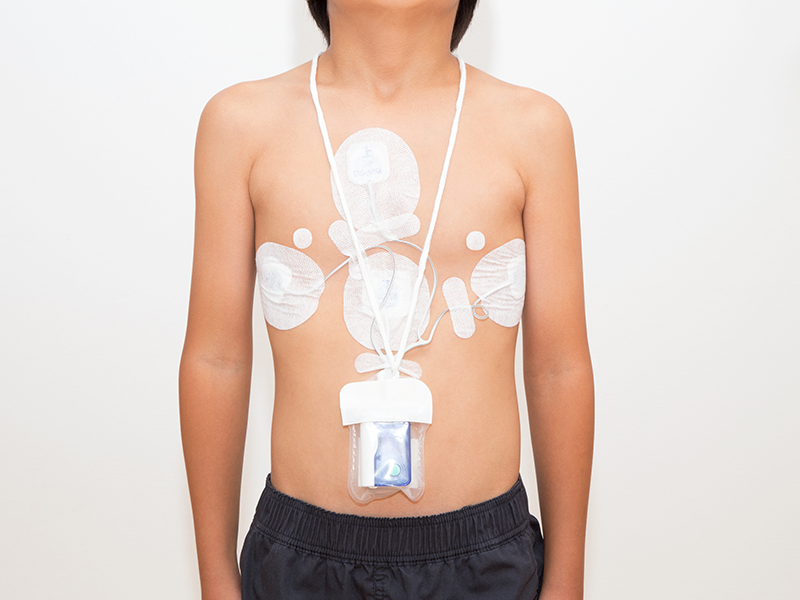 Holter Electrocardiogram
