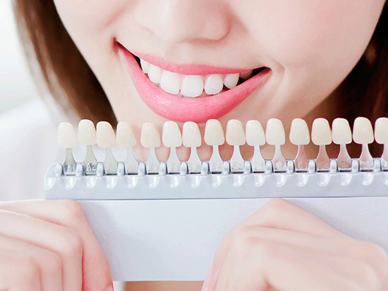 Whitening