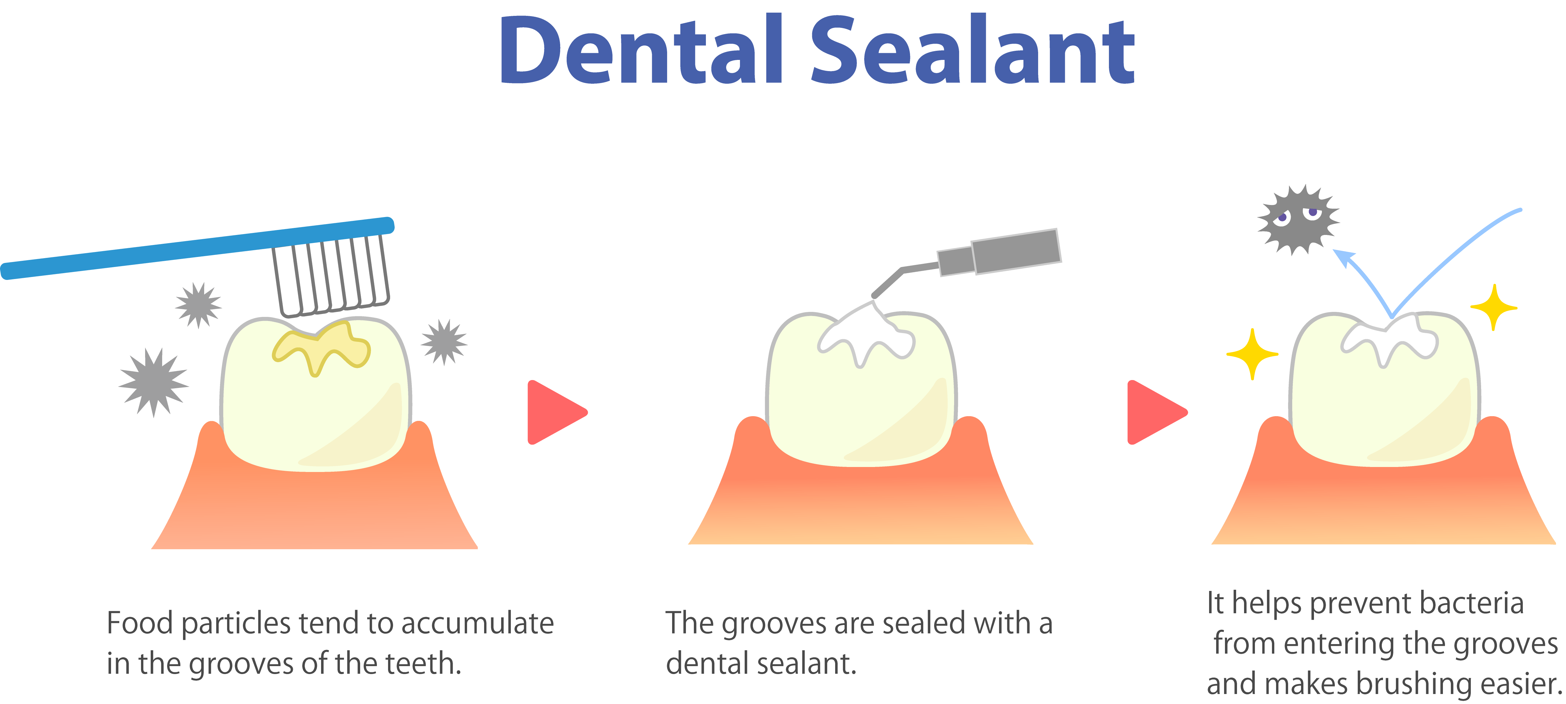 Sealant